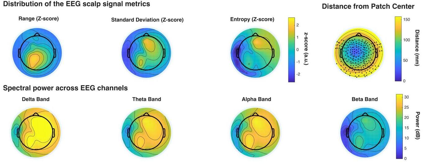 Topographic maps showing how μECoG at Motor Cortex projects across the scalp