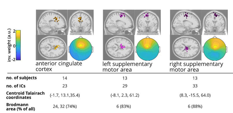 The effect of fiducial mismarking on EEG source estimation.